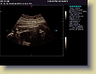 Week32-Siemens-Ultrasound-Dec2011 (5) * 1024 x 768 * (148KB)